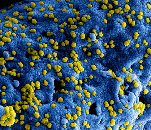 Hantavirus